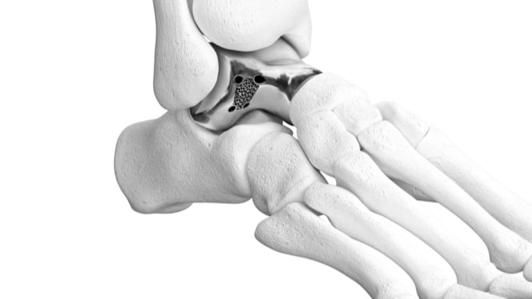 3d-printed-orthopedic-implant-maker-restor3d-raises-$104m