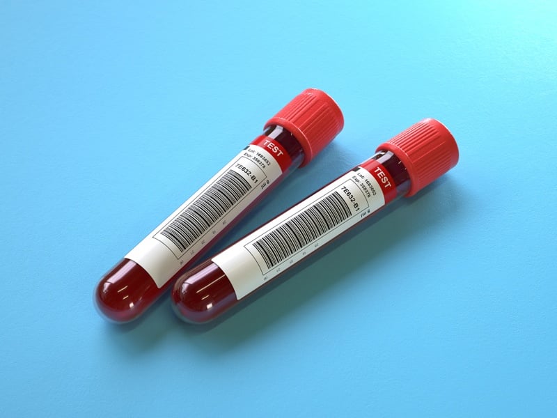 exact-sciences-rolls-out-cancerguard-multi-cancer-blood-test