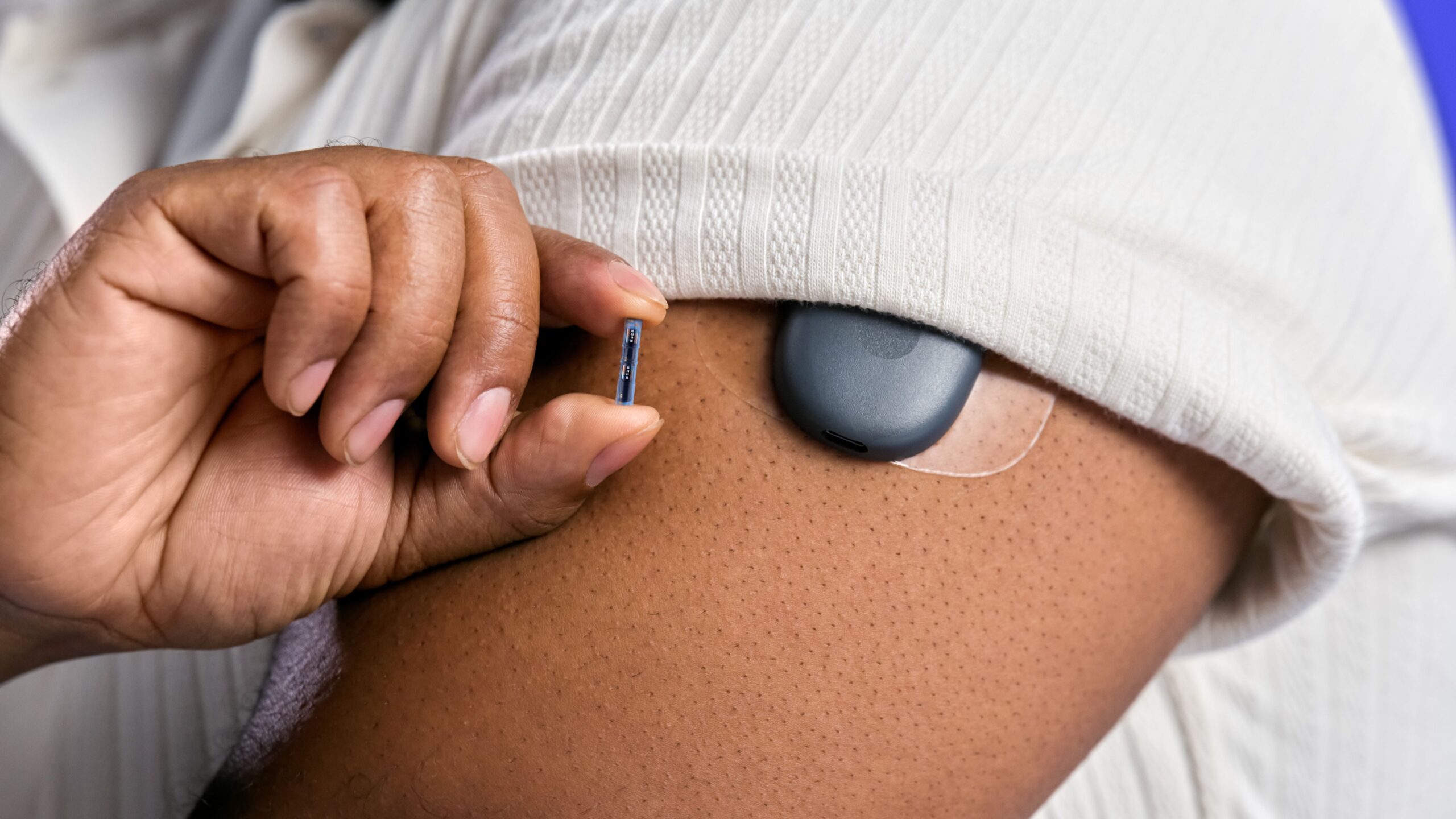 senseonics-to-retake-eversense-cgm-commercial-control-from-ascensia-diabetes-care