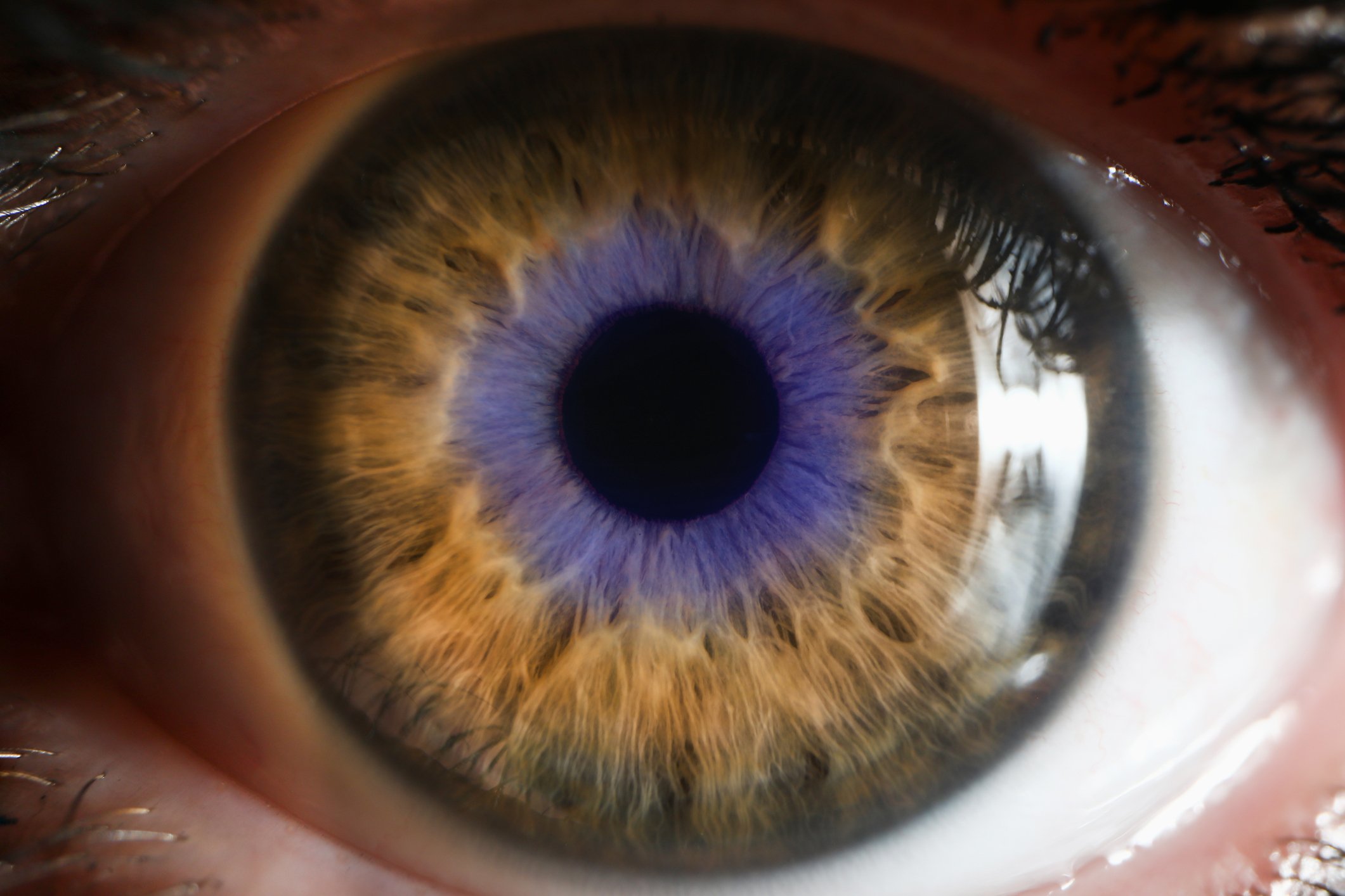 science-corp.’s-retinal-implant-restores-some-vision-in-patients-with-macular-degeneration