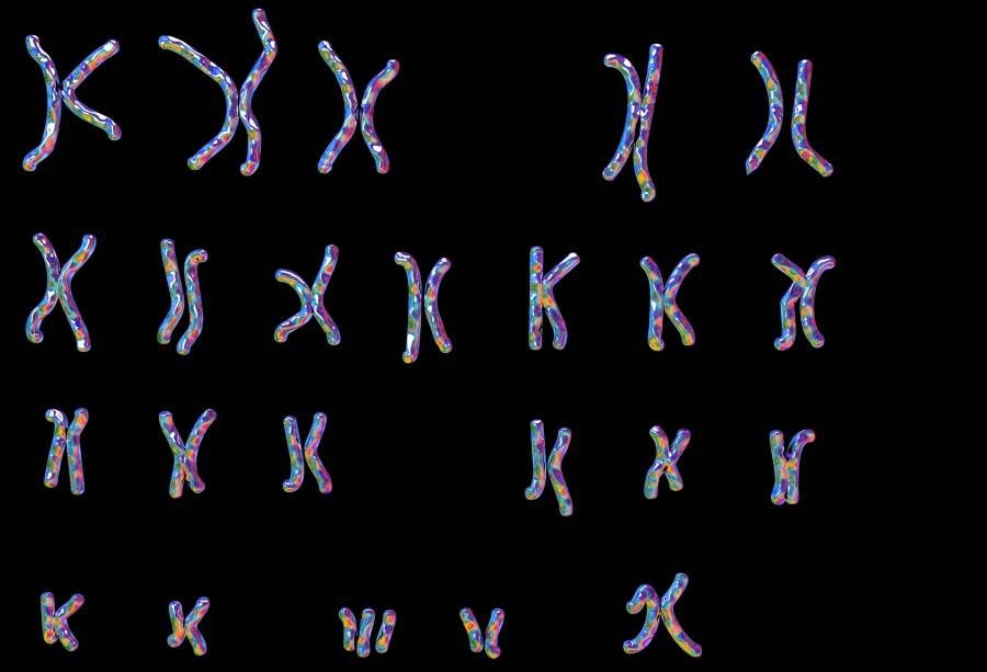 overactive-hmgn1-may-underlie-heart-defects-in-down-syndrome