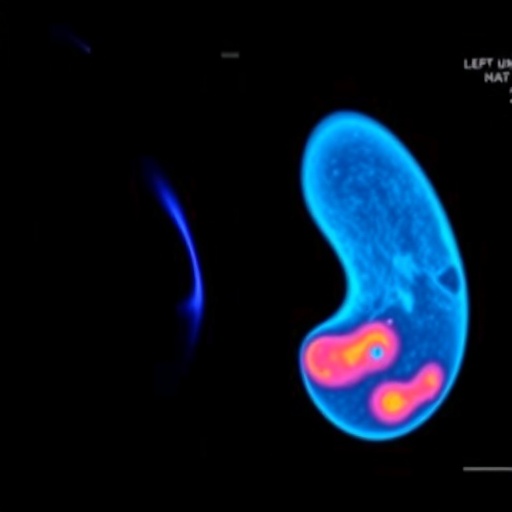 ultrasound-boosts-lenvatinib’s-effects-on-thyroid-cancer