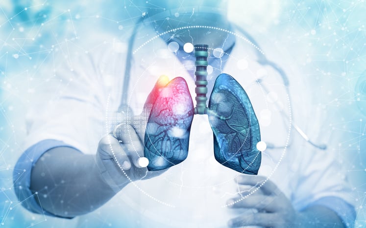 thermo-fisher-rolls-out-biopsy-test-to-better-assess-lung-transplant-rejection-risk