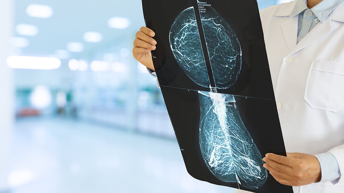 spanish-oncology-research-group-medsir-infuses-ai-into-breast-cancer-trials