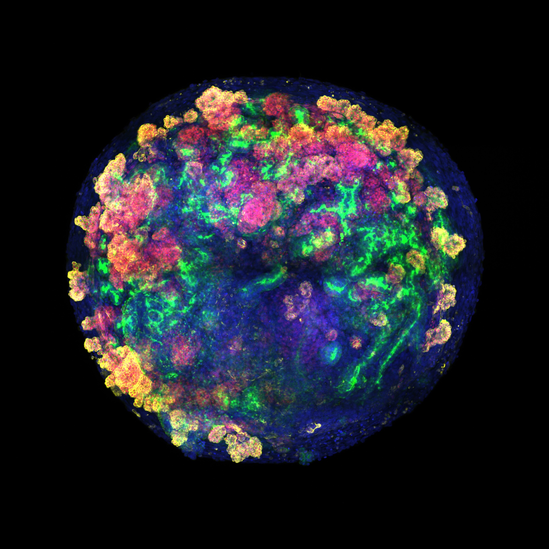 in-a-first,-scalable-production-of-human-kidney-organoids-using-perfused-pig-kidneys